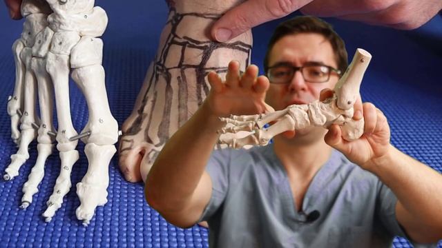 How To Tell If My Foot or Ankle Injury is BAD! [Sprained or BROKEN?] смотреть онлайн