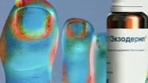Экзодерил 20сек март11