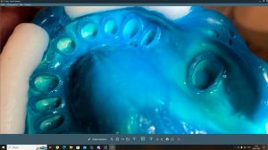 Правильный оттиск спидексом - снятие двухслойного слепка, этапы, ошибки