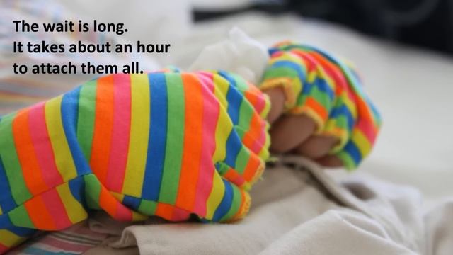 EEG test for seizures in children смотреть онлайн