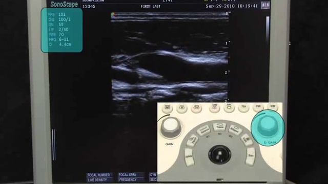 Best Color Doppler Ultrasound Scanner SonoScape S8 | System Controls смотреть онлайн