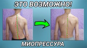Когда потерял надежду. Миопрессура.