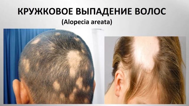 ✂️ПРОФЕССИОНАЛЬНЫЕ ЗАБОЛЕВАНИЯ ✂️ и БОЛЕЗНИ ВОЛОС.✂️ смотреть онлайн