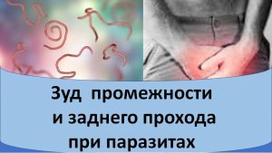 Зуд промежности и перианальной области при паразитах