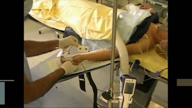 монитор анальгезии Альгискан смотреть онлайн