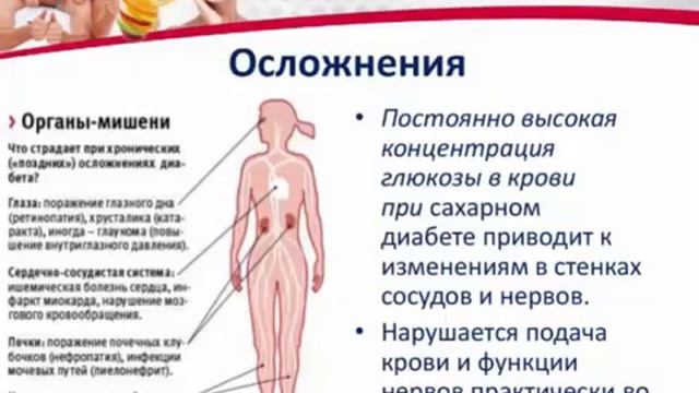 PM International Сахарный диабет и FitLine доктор Галина Костина смотреть онлайн
