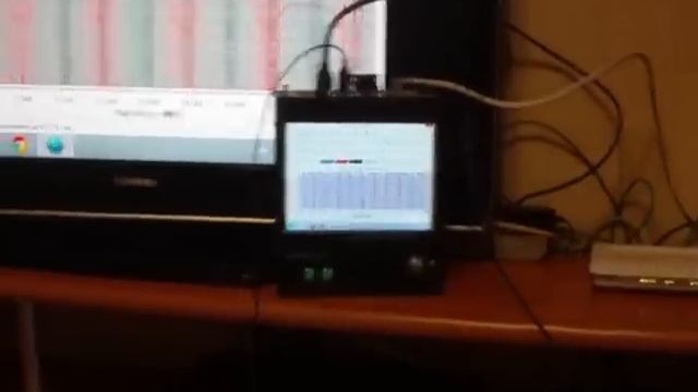 Альяно ЧБЧ 1 тест смотреть онлайн