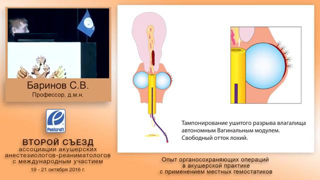 Гемоблок при органосохраняющих операциях в акушерской практике проф Сергей Баринов смотреть онлайн