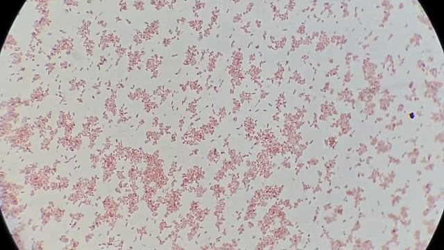 ESBL Producer, XDR  Strain Klebsiella Pneumoniae Isolation From Urine Culture And Sensitivity