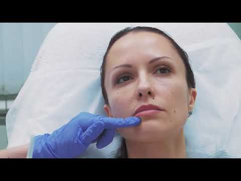 Контурная пластика смотреть онлайн