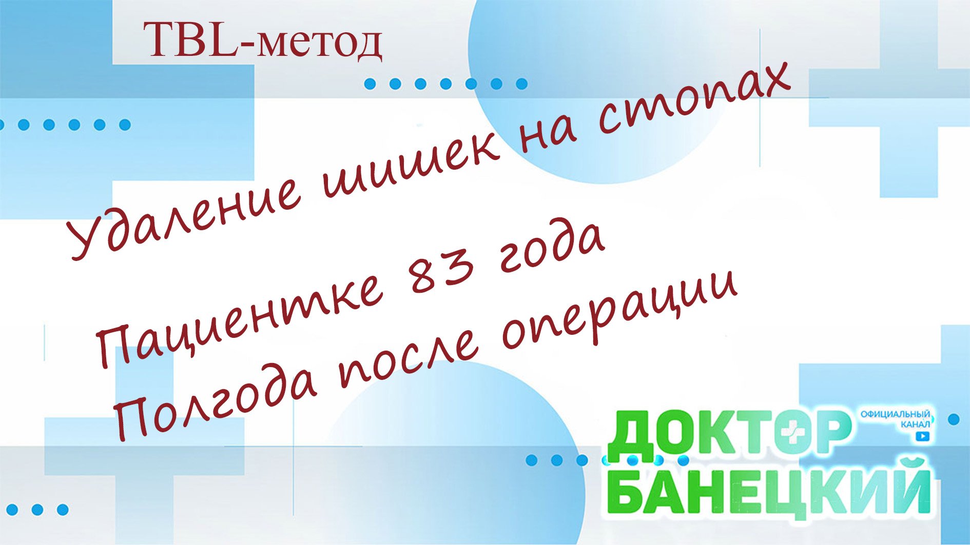 TBL - метод. Лечение косточек на стопах. Отзыв пациентки 83х лет. полгода после операции.