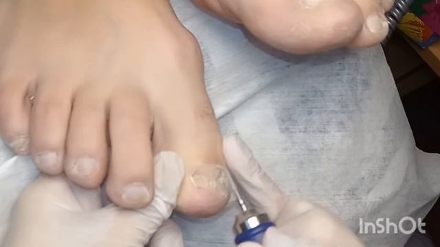 22... подология дома( #подолог #педикюр