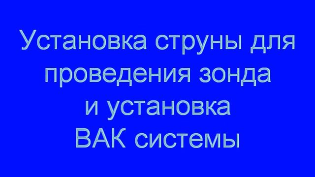 Endoscopic Vacuum Therapy for Esophageal Leakage смотреть онлайн