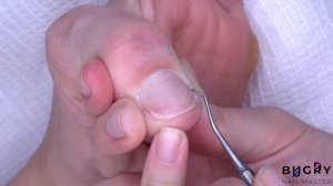 ПЕДИКЮР САМА СЕБЕ / Наращиваю Сломанный Угол Ногтя / Cosmoprofi/ Татьяна Бугрий