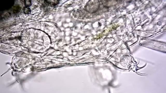 Микроскопия Тихоходка 100х , 400х