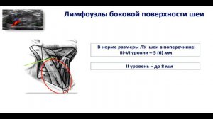 Классификация TI-RADS в оценке степени злокачественности узлов щитовидной железы. Фисенко Е.П.