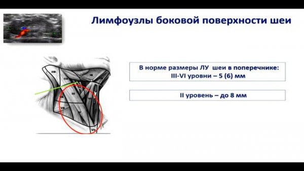 Классификация TI-RADS в оценке степени злокачественности узлов щитовидной железы. Фисенко Е.П.