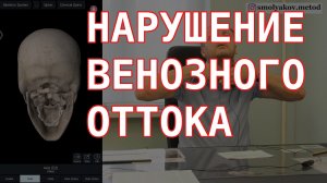 Нарушение венозного оттока. Причина нарушения венозного оттока и лечение.