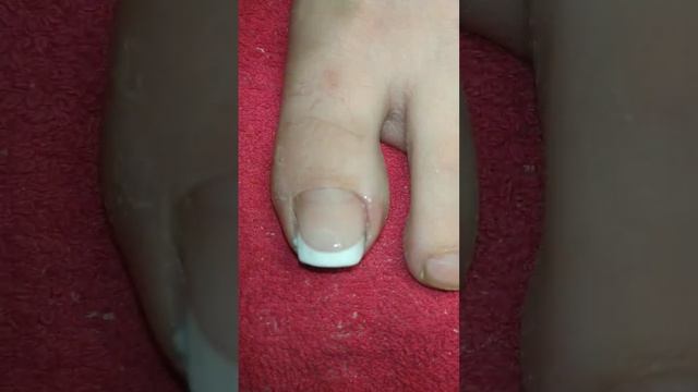Акрил френч,на ногах и руках ДО И ПОСЛЕ #обучениеманикюру #shorts #20nails #маникюр #гельлак #nails смотреть онлайн
