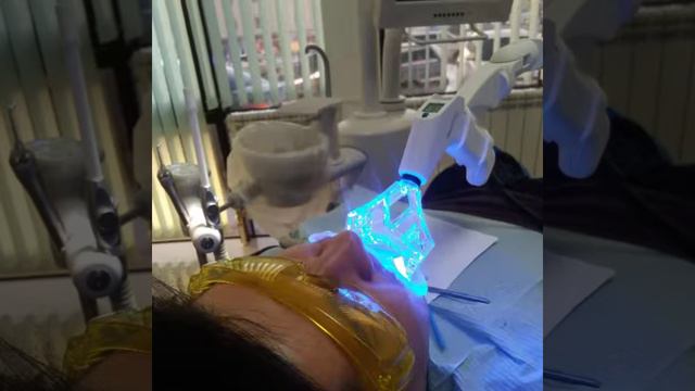 Отбеливание зубов LumiBrite (Люмибрайт) Астана смотреть онлайн