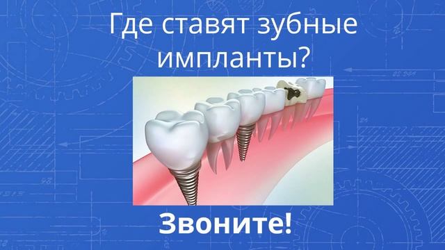 зубные импланты для детей оренбург - Звоните! 560-560 смотреть онлайн