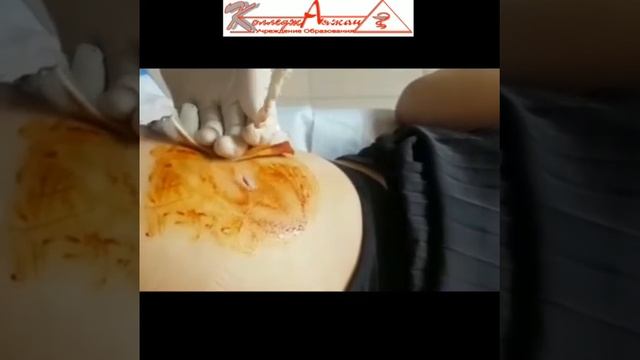 Обработка раны и перевязка при постинъекционном осложнении смотреть онлайн