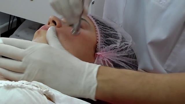 Алмазная микродермабразия.(пилинг)www.cosmetolog-kharkov.com (093)761-83-96 Харьков смотреть онлайн
