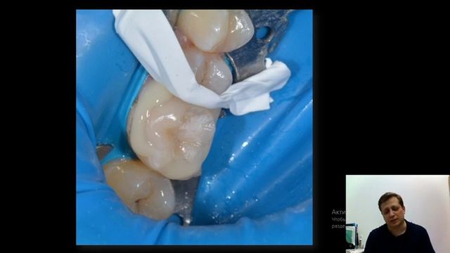 Александр Григорьев - «Адгезивная техника в постэндо» смотреть онлайн