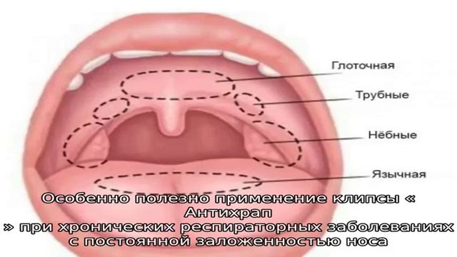 Приспособление от храпа: виды и особенности смотреть онлайн