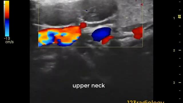 Ultrasound Case (Neck) смотреть онлайн