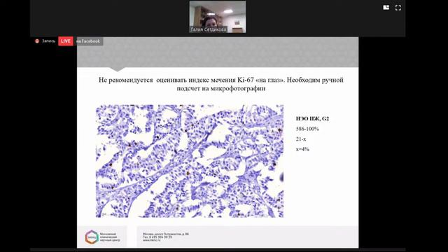 Онлайн-конференция «Инновационные технологии диагностики и лечения нейроэндокринных опухолей» смотреть онлайн