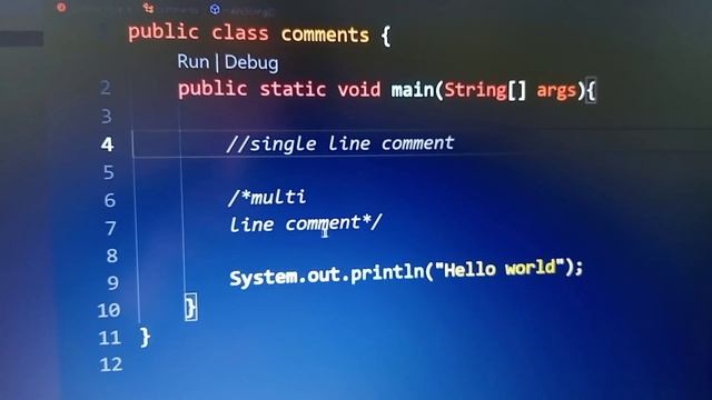 single line.......Multiline comment in java #java #2 смотреть онлайн