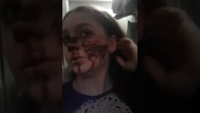 Меня побили! Жесть синяки,порезы смотреть онлайн