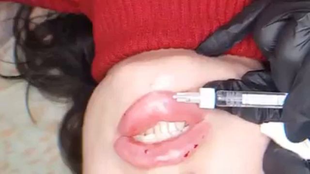 Делаем Губы смотреть онлайн