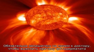 Аллергия на солнце: чем опасен и как лечить фотодерматит