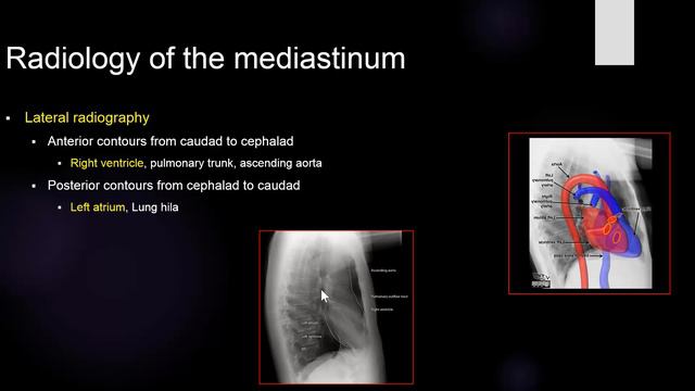 2-Anatomy of the mediastinum смотреть онлайн