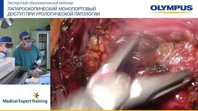 Вебинар от 26.06.20. Клиническая больница Святителя Луки смотреть онлайн