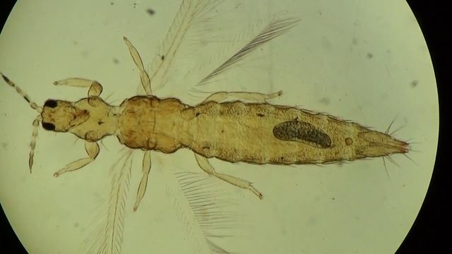Under Microscope: Frankliniella occidentalis, Цветочный Трипс в Украине, Kiev Ukraine смотреть онлайн