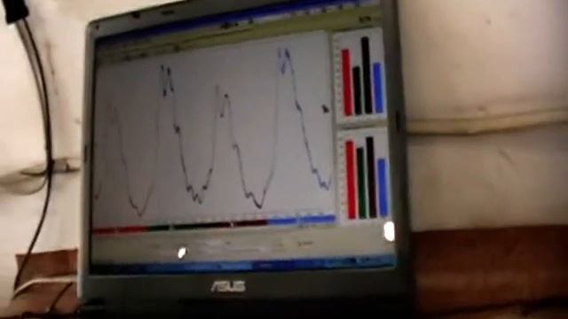 ДЕУ СЕНС 1.4 прогар прокладки между 2 и 3 цилиндром. смотреть онлайн