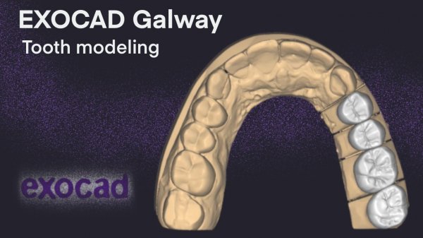 ExoCad Galway tooth modeling 1