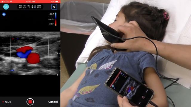 Butterfly IQ: Pocket-Sized Ultrasound