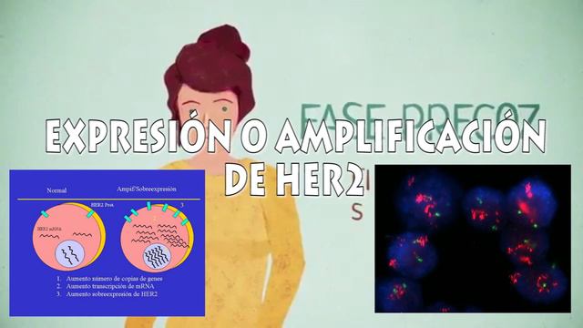 Pronóstico De Cáncer De Mama