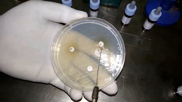 Haemophilus influenzae Colony Morphology, Growth around XV factors and serotyping смотреть онлайн