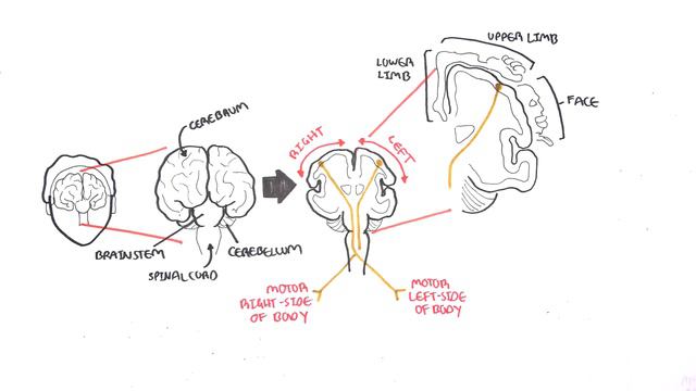 Cerebral Palsy - (DETAILED) Overview