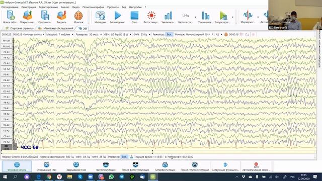 Порядок проведения рутинного ЭЭГ-обследования смотреть онлайн