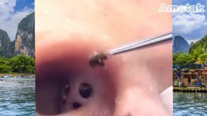 Как чистить уши 2020