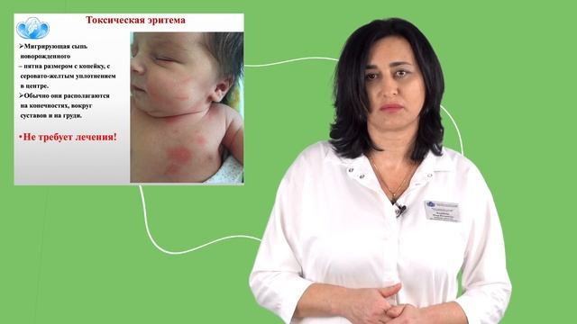 Макиева Мзия Ильинична - Токсическая эритема смотреть онлайн