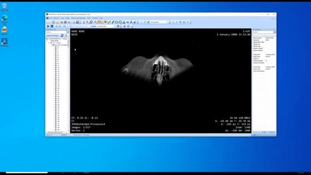How to Export DICOM files to JPG with MicroDicom смотреть онлайн