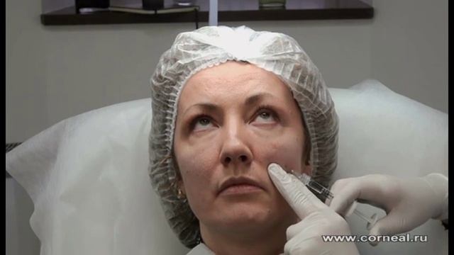 Корректируем носогубки не прикасаясь к ним смотреть онлайн