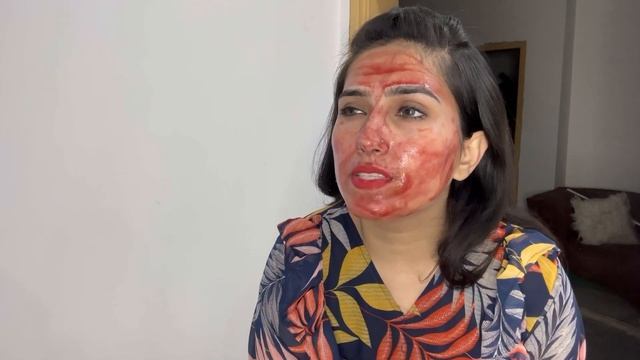 Never Using The Ordinary Peel On My Face Again #theordinary #shorts